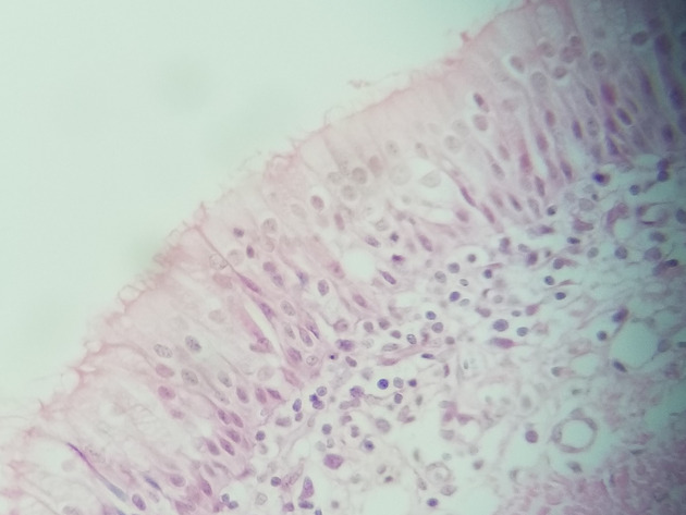 Pseudostratified Epithelium Slides - Pseudostratified Epithelium 12 400X